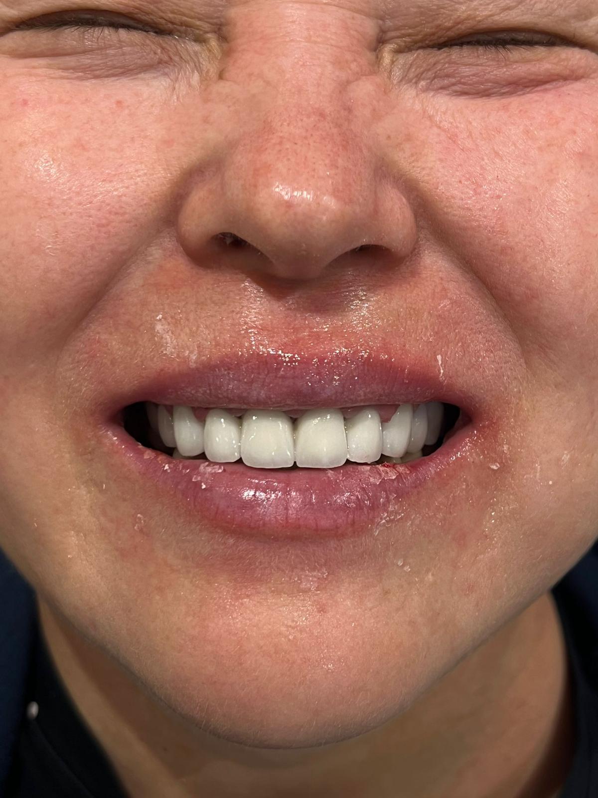 ECE Dental Patient Transformation